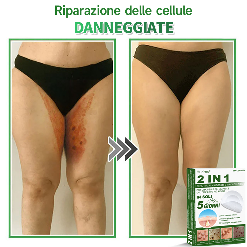 👉Hudros®🐒Cerotto 2 in 1 a Micro-aghi e Idrocolloide | Elimina Nevi in Rilievo, Acne, Verruche Piatte e Fibromi Cutanei | Migliora Rughe, Cicatrici e Imperfezioni | Cerotti Stella Invisibili per Brufoli su Viso e Corpo | 144 pz.🐑