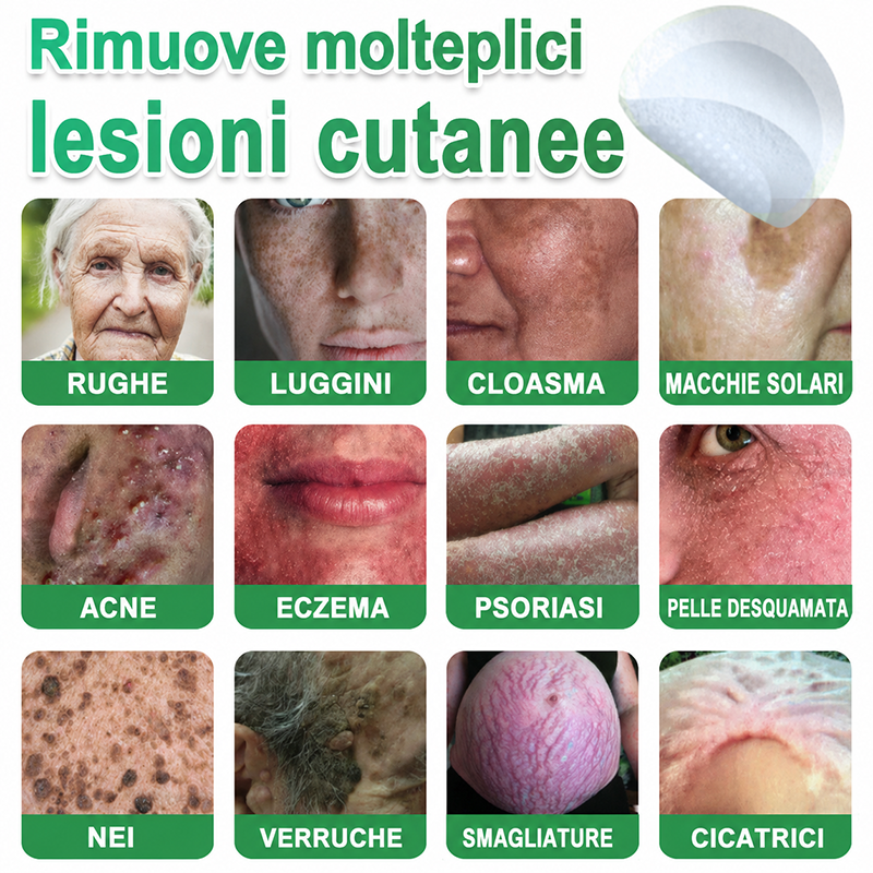 👉Hudros®🐒Cerotto 2 in 1 a Micro-aghi e Idrocolloide | Elimina Nevi in Rilievo, Acne, Verruche Piatte e Fibromi Cutanei | Migliora Rughe, Cicatrici e Imperfezioni | Cerotti Stella Invisibili per Brufoli su Viso e Corpo | 144 pz.🐑