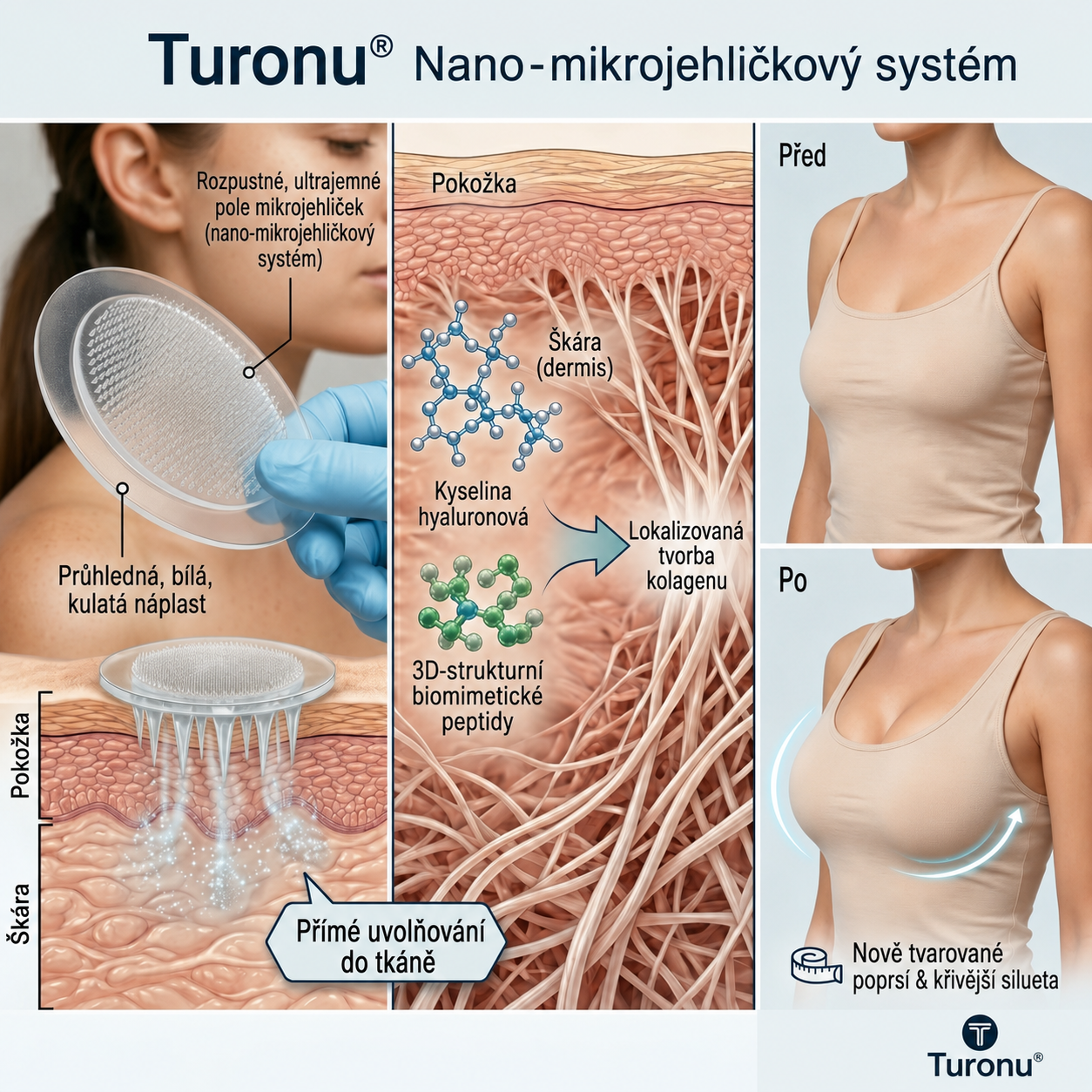✨Turonu® 😗🍨 Pokročilá Nano-Mikrojehličková Náplast pro Cílené Zvětšení Poprsí🧪🇨🇿