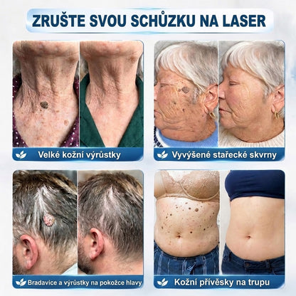 𝑻𝒓𝒊𝒍𝒖𝒎𝒊𝒂®💎🍃 Prémiový roller | 🔬 Na odstranění bradavic, znamének a výrůstků 🇨🇿