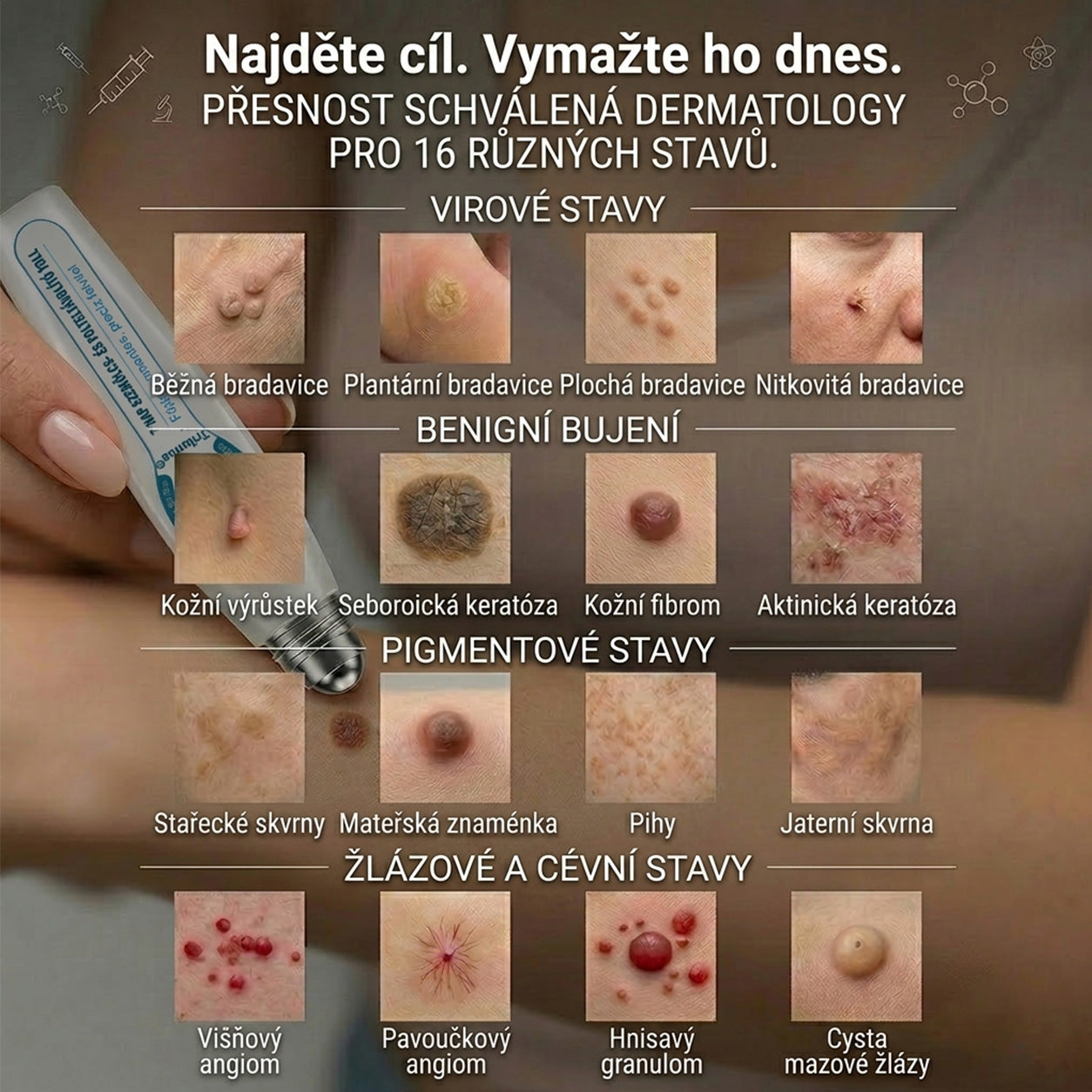 𝑻𝒓𝒊𝒍𝒖𝒎𝒊𝒂®💎🍃 Prémiový roller | 🔬 Na odstranění bradavic, znamének a výrůstků 🇨🇿