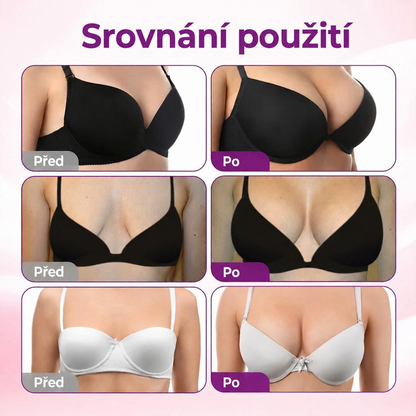 ✨Turonu® 😗🍨 Pokročilá Nano-Mikrojehličková Náplast pro Cílené Zvětšení Poprsí🧪🇨🇿