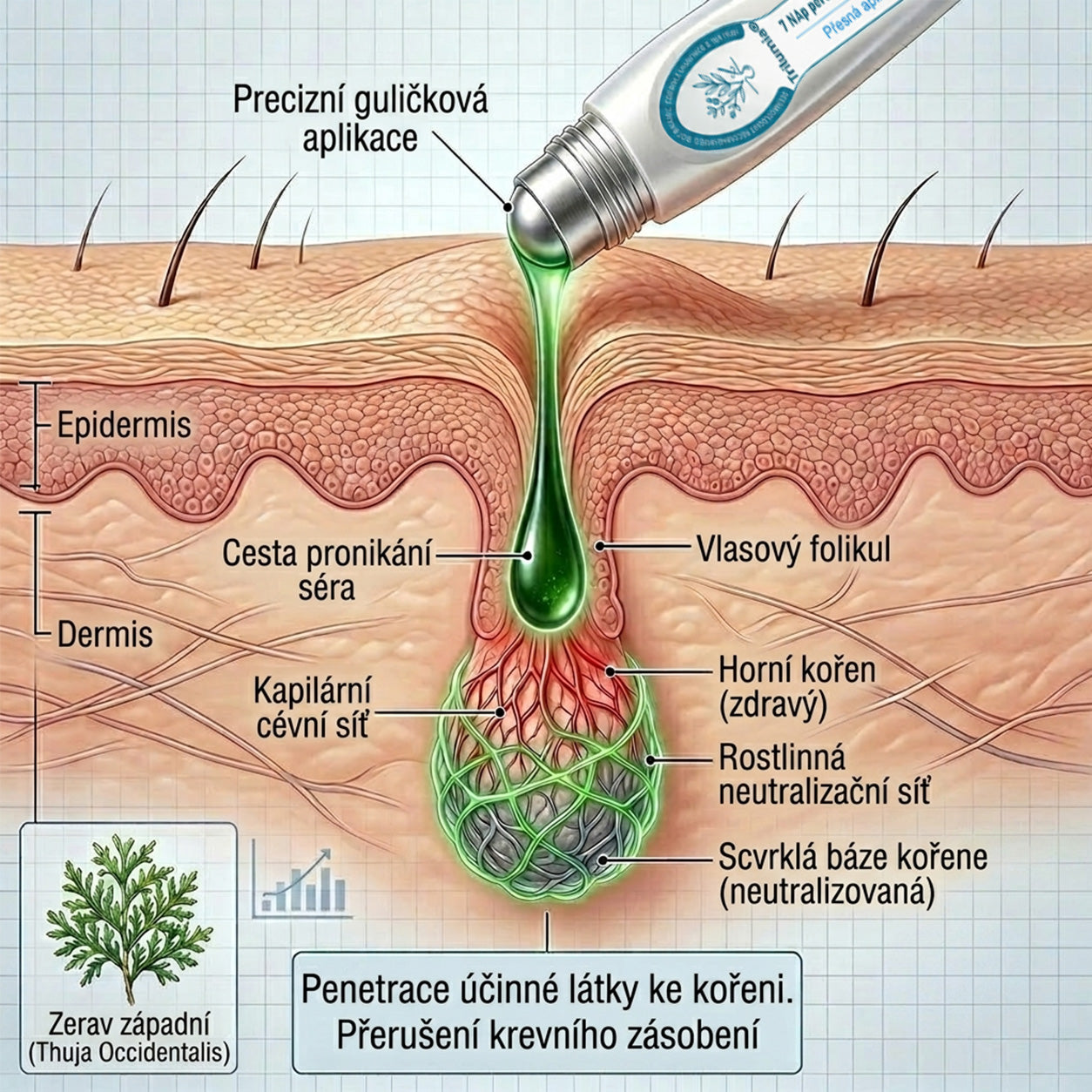 𝑻𝒓𝒊𝒍𝒖𝒎𝒊𝒂®💎🍃 Prémiový roller | 🔬 Na odstranění bradavic, znamének a výrůstků 🇨🇿