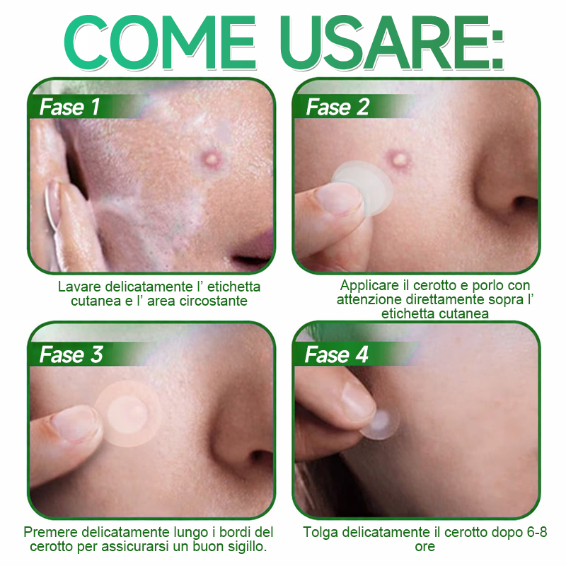👉Hudros®🐒Cerotto 2 in 1 a Micro-aghi e Idrocolloide | Elimina Nevi in Rilievo, Acne, Verruche Piatte e Fibromi Cutanei | Migliora Rughe, Cicatrici e Imperfezioni | Cerotti Stella Invisibili per Brufoli su Viso e Corpo | 144 pz.🐑