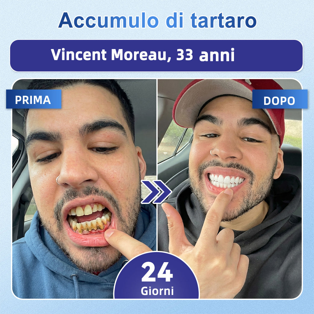 🦷 Dì Addio a Sensibilità e Fastidi! 🐠🐠GаrаgеLіnе® Tideglusib Strisce Orali – Riparazione Rapida per Denti e Gengive