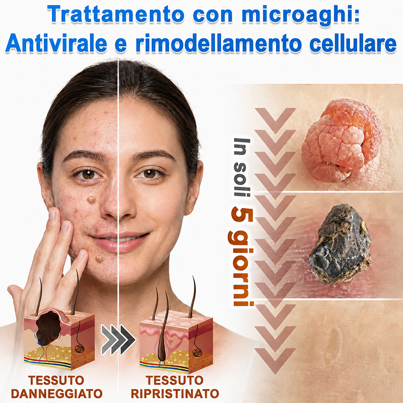 👉Hudros®🐒Cerotto 2 in 1 a Micro-aghi e Idrocolloide | Elimina Nevi in Rilievo, Acne, Verruche Piatte e Fibromi Cutanei | Migliora Rughe, Cicatrici e Imperfezioni | Cerotti Stella Invisibili per Brufoli su Viso e Corpo | 144 pz.🐑