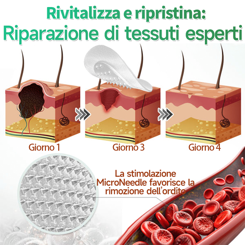 👉Hudros®🐒Cerotto 2 in 1 a Micro-aghi e Idrocolloide | Elimina Nevi in Rilievo, Acne, Verruche Piatte e Fibromi Cutanei | Migliora Rughe, Cicatrici e Imperfezioni | Cerotti Stella Invisibili per Brufoli su Viso e Corpo | 144 pz.🐑