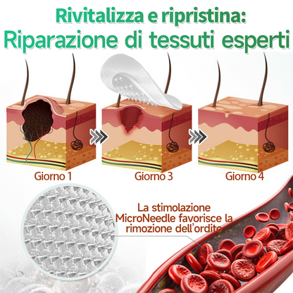 👉Hudros®🐒Cerotto 2 in 1 a Micro-aghi e Idrocolloide | Elimina Nevi in Rilievo, Acne, Verruche Piatte e Fibromi Cutanei | Migliora Rughe, Cicatrici e Imperfezioni | Cerotti Stella Invisibili per Brufoli su Viso e Corpo | 144 pz.🐑