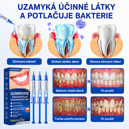 🩵🇨🇿 HEATWOLF® 🦷 GumRevive parodontální opravný gel🧇