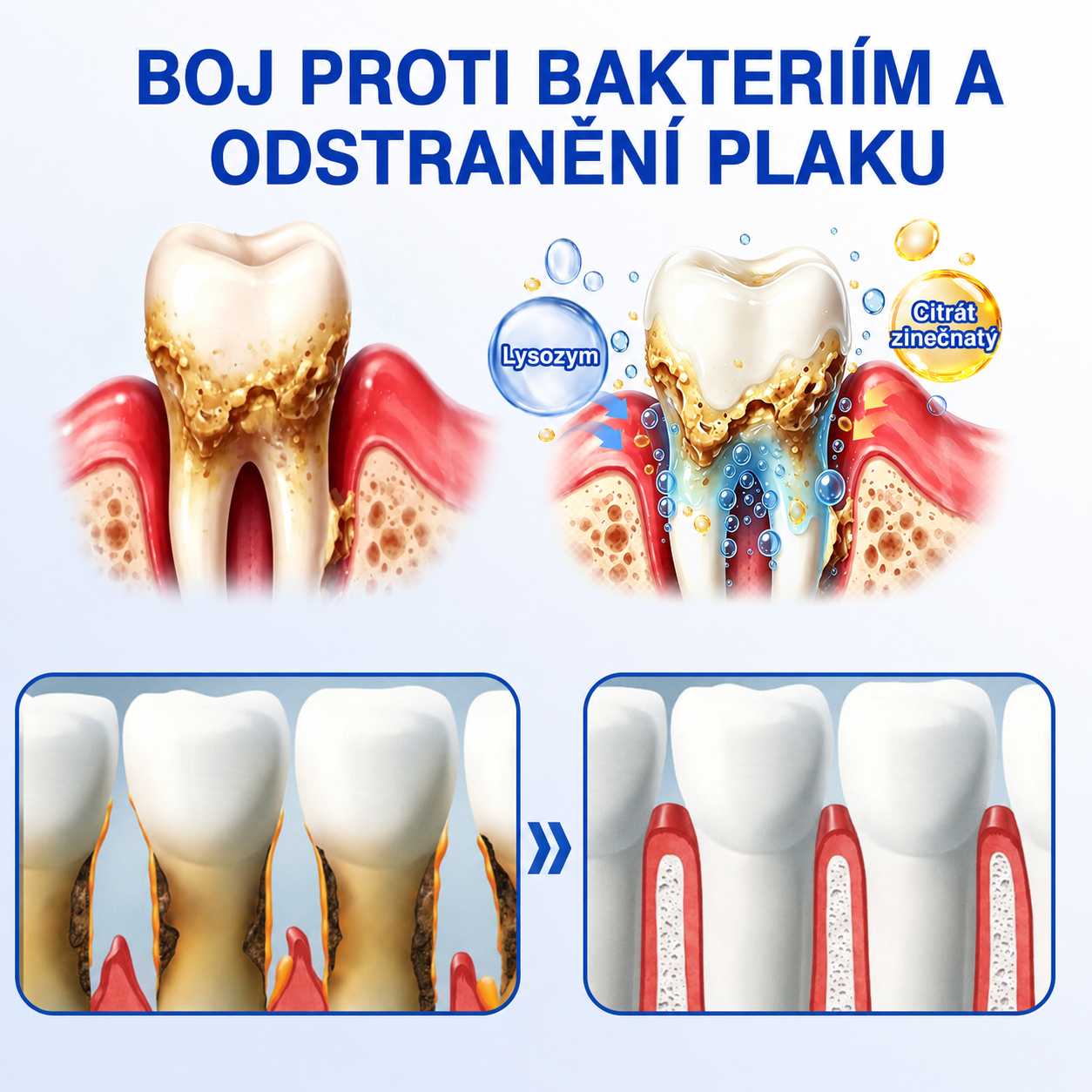 🩵🇨🇿 HEATWOLF® 🦷 GumRevive parodontální opravný gel🧇