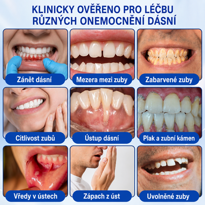 🩵🇨🇿 HEATWOLF® 🦷 GumRevive parodontální opravný gel🧇
