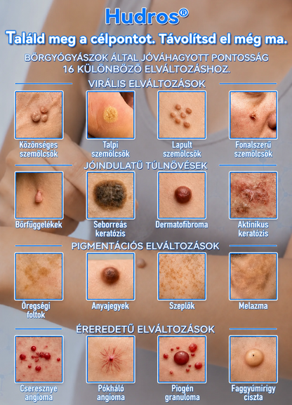 ✨ 𝑯𝒖𝒅𝒓𝒐𝒔® 💗 2-az-1-ben Mikrotű & Hidrokoloid Tapasz 🔬| Kiemelkedő Anyajegyek, Pattanások, Lapos Szemölcsök & Bőrkinövések Eltávolítója🛡️🦠 | Ráncok, Hegek & Bőrhibák Javítása | Láthatatlan Csillag Pattanástapasz Arcra & Testre | 144 db 🇭🇺